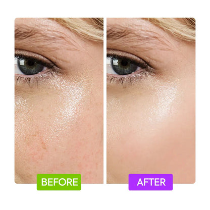 AHA Resurfacing Serum with Glycolic and Lactic Acid