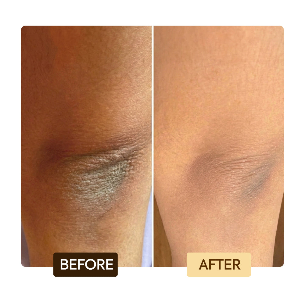 Clarifying exclusive toning set unify skin tone