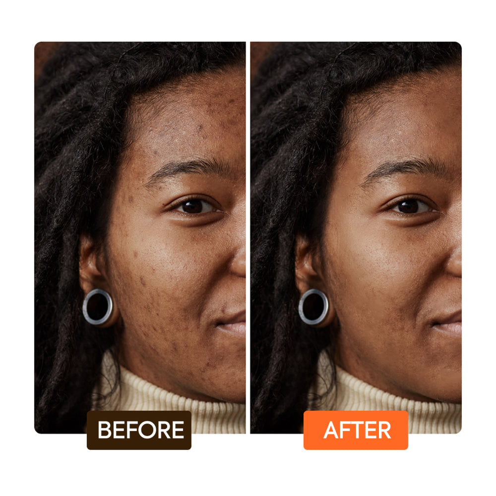 Extreme argan exfoliating soap with apricot seed extract