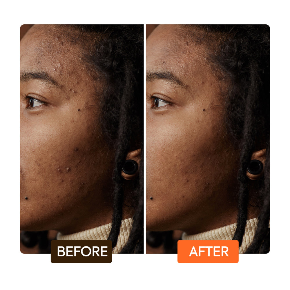 Extreme carrot oil toning dark spot corrector serum
