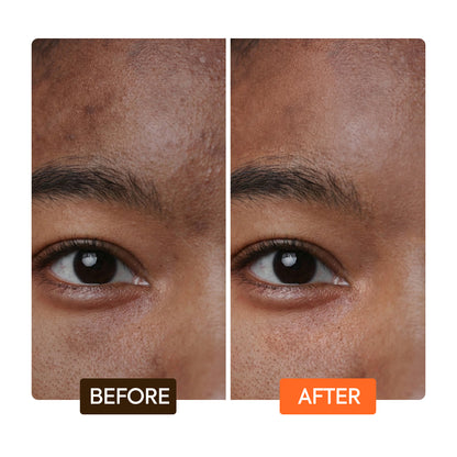 Extreme carrot tone boosting pigment clarifying gel