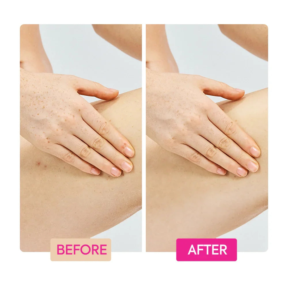 Ginger extract tranexamic acid retinol body cream