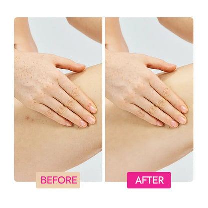 Ginger extract tranexamic acid retinol body cream