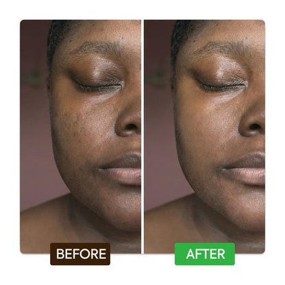 Powerful brightening serum kojic acid targets spots