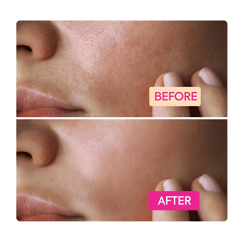 Makari niacinamide facial cleansing bar