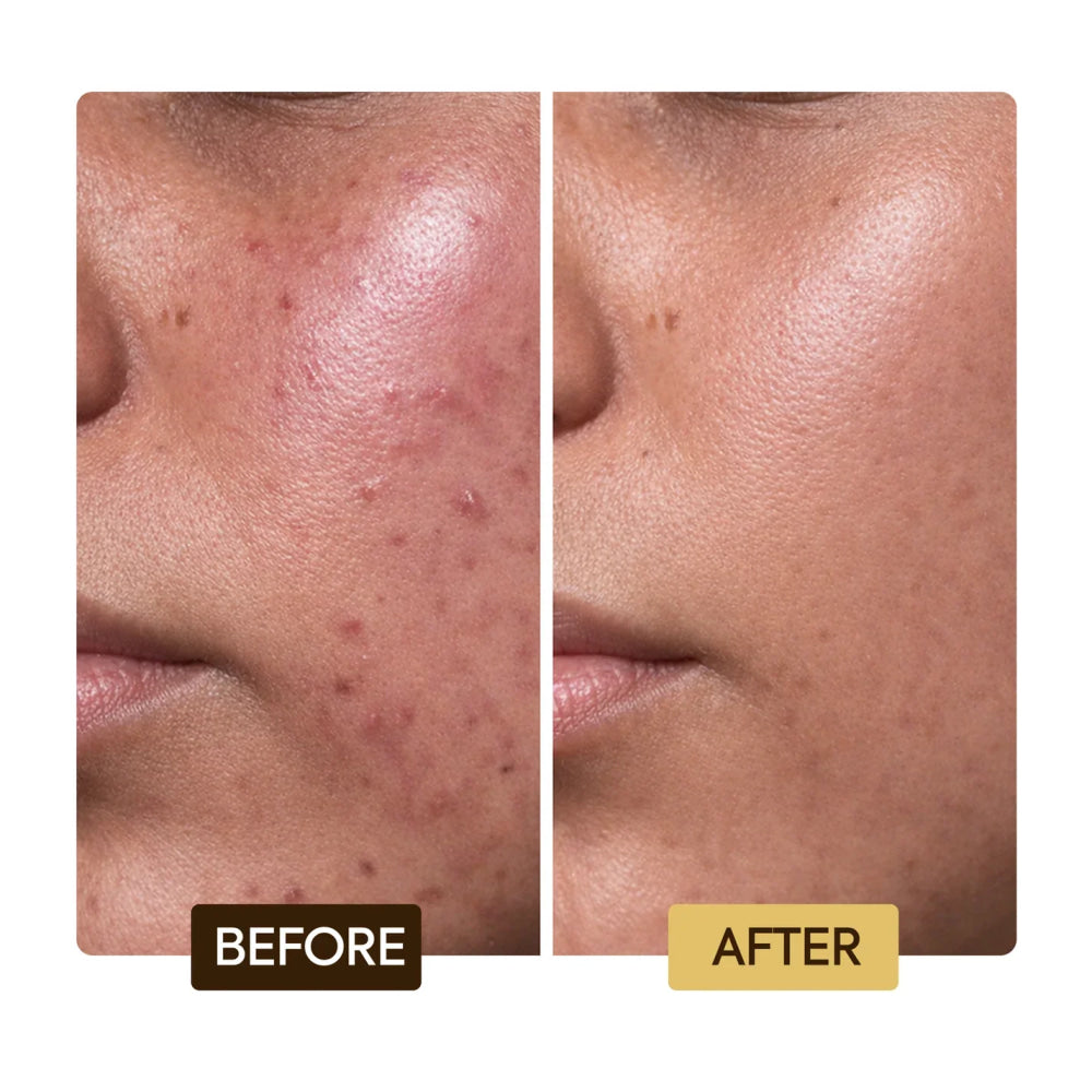 Makari skin repairing & clarifying serum new package